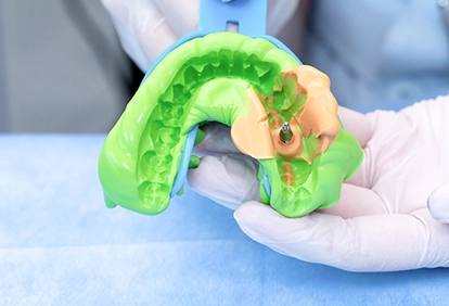 Huge Light Curing Tray